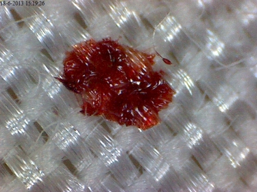 Bloodstain Pattern Analysis on Textile Course: 13th-17th of April 2026
